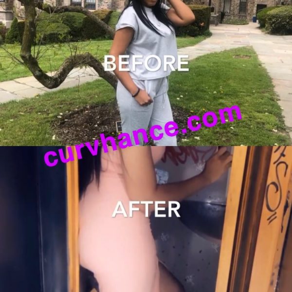 Customer submission. Before and After results from just 28 days of Curvhance Buttox-Tea